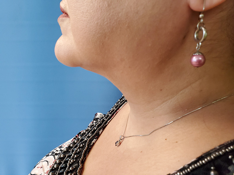 Profile view of a woman wearing a pink bead earring and a necklace. Blue background