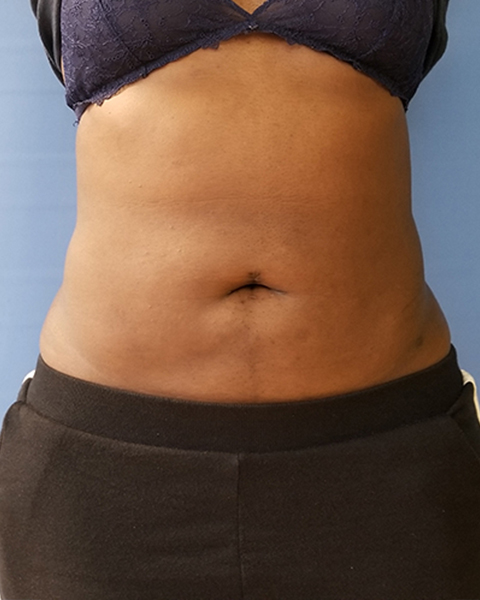 Person's abdomen is visible, wearing a black bra and dark pants, with a neutral background