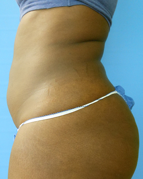 Side view of a person with a curved torso, wearing blue underwear against a blue background