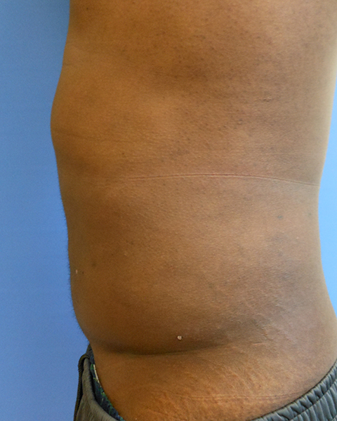 Side view of a torso with a smooth, dark skin tone against a blue background