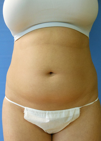 Person's midsection visible, wearing a white bra and white underwear against a blue background
