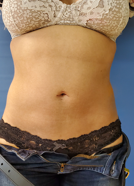 Close-up of a midsection, featuring a lace bra and waistband of low-rise jeans. Blue background