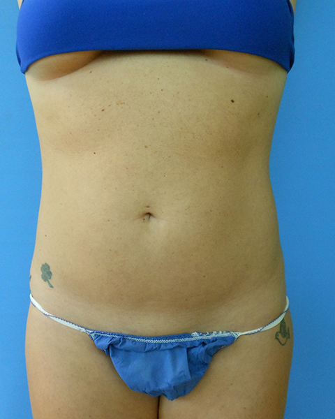 Person viewed from the waist up, wearing a blue bikini top and bottom, against a blue background