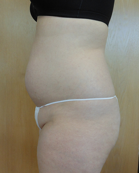Side view of a person’s abdomen wearing black and white underwear