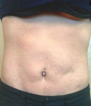 Bare midsection with a belly button piercing, partially covered by clothing
