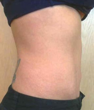 Side view of a person’s torso, showing bare skin and a visible tattoo