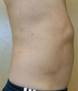 Side view of a male torso showing the abdomen and part of the waist