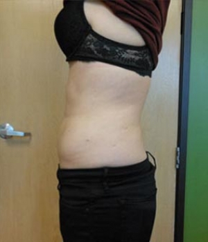 Side view of a person lifting their shirt, showing their midsection and wearing a black bra