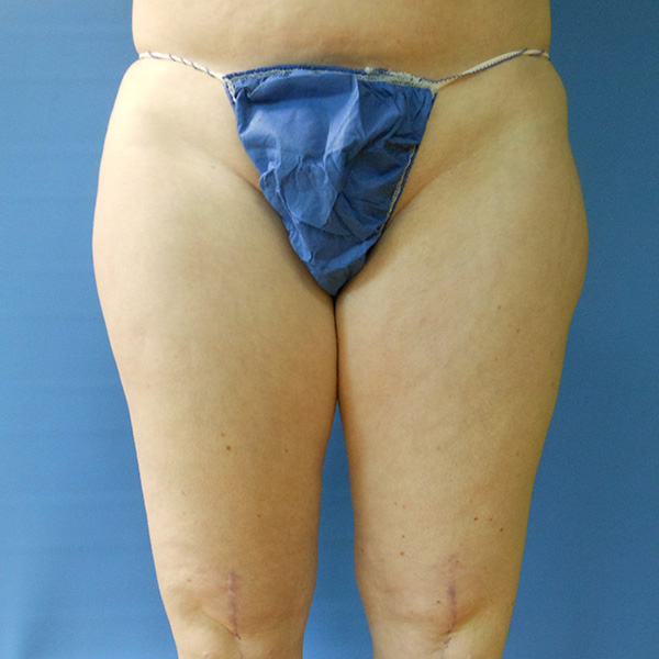 A person wearing a blue thong with a plain background
