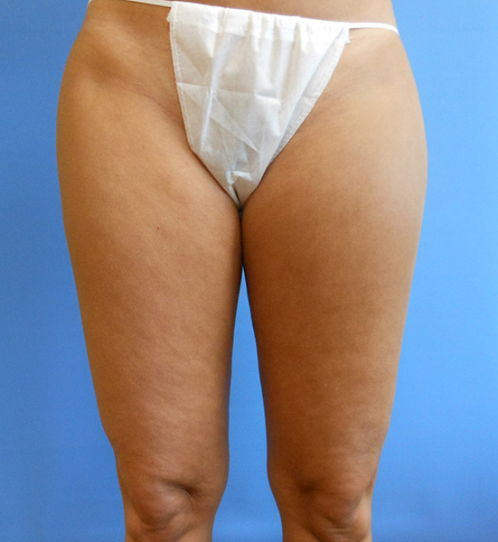 A person’s lower body wearing a white thong against a blue background
