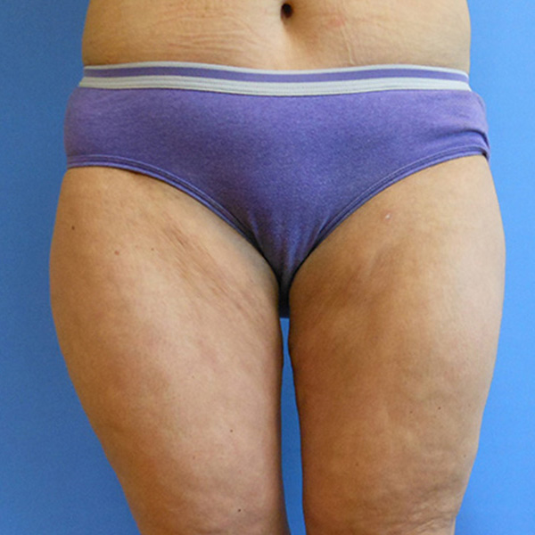 Person wearing purple underwear, standing against a blue background. Upper thighs are visible
