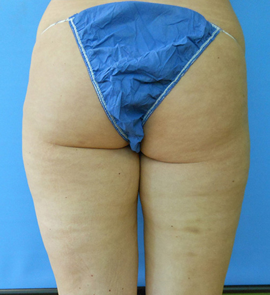 Person's lower body seen from behind, wearing a blue thong