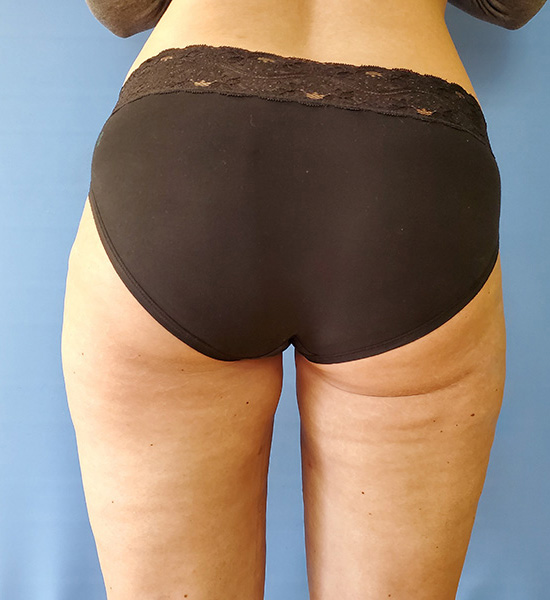 Back view of a person wearing black underwear, standing against a blue background