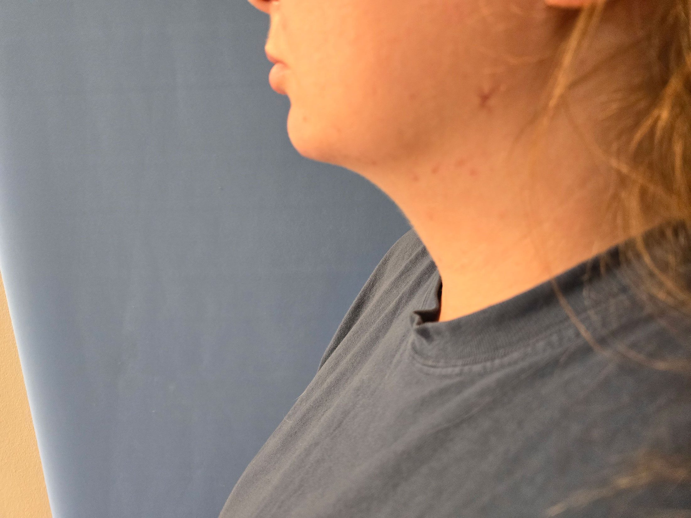 Profile view of a person with a neck and shoulder, wearing a blue shirt. Background is blue