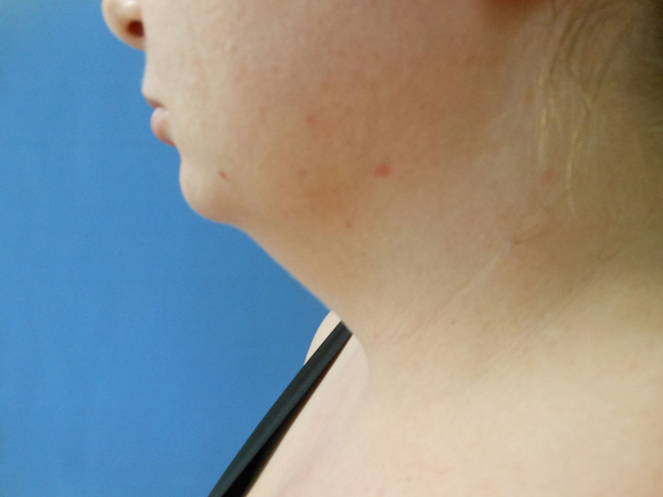 Close-up side profile of a person's neck and chin against a blue background