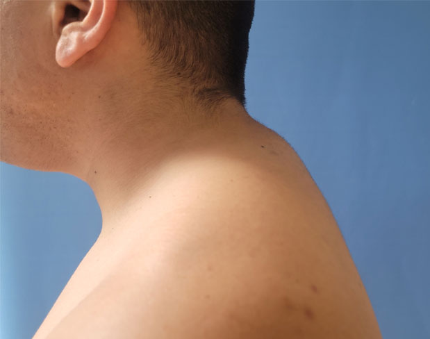 Profile view of a person’s neck and shoulder against a blue background